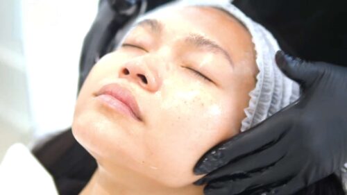 Skin Tightening Method