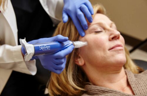 SkinPen Precision Microneedling